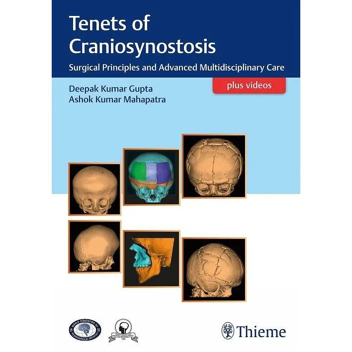 Tenets of Craniosynostosis (Hardcover)