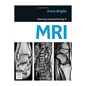 Planning and Positioning in MRI (Paperback)